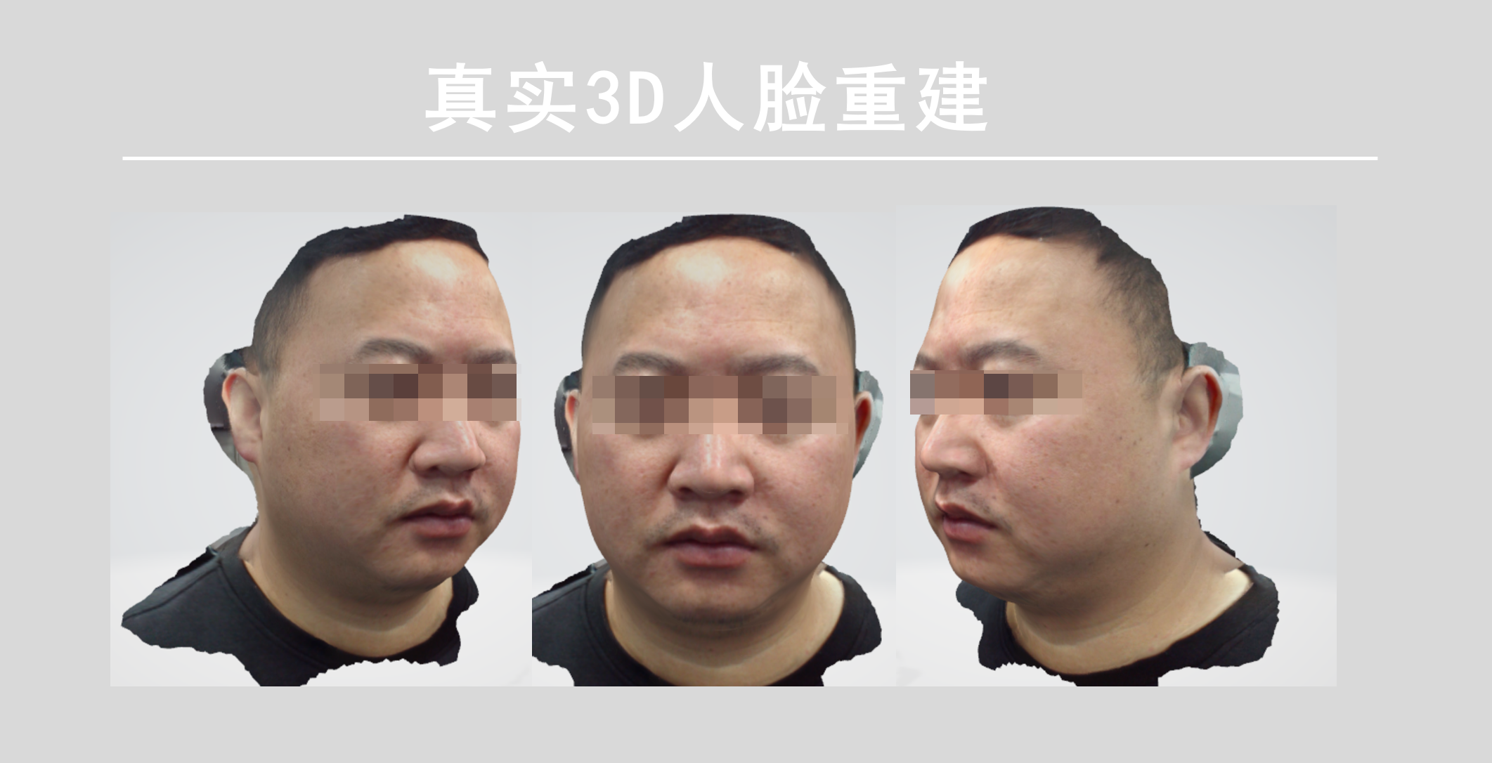 深度相機在模擬整形的作用